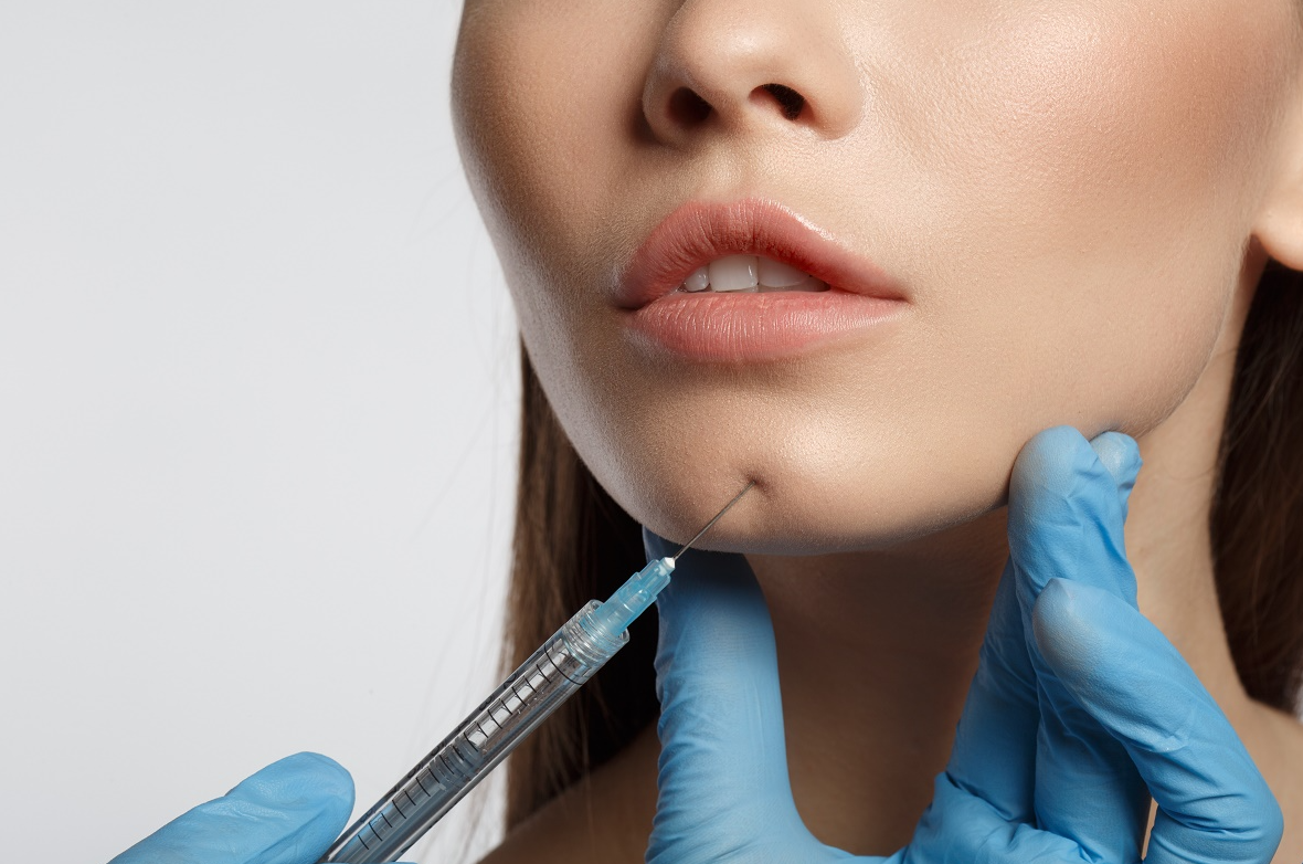 Facial Fat Grafting: What to Know Before Choosing Treatment